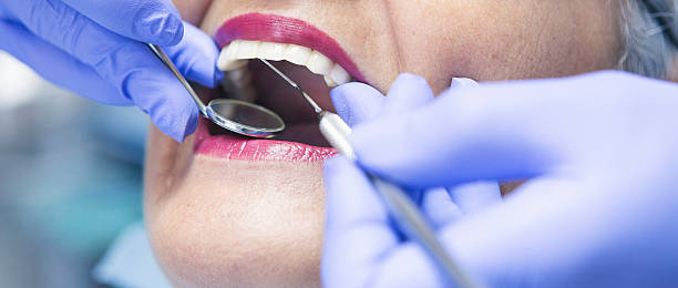 Best Chipped Tooth Repair Near Me  in USA